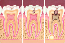 endodontia-1